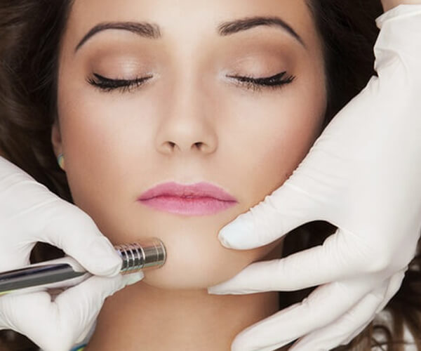 microdermabrasion-treatment-face