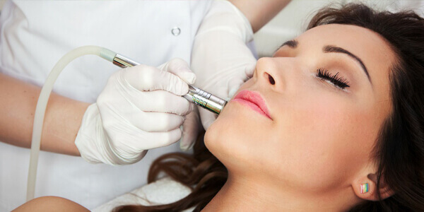 microdermabrasion-treatment